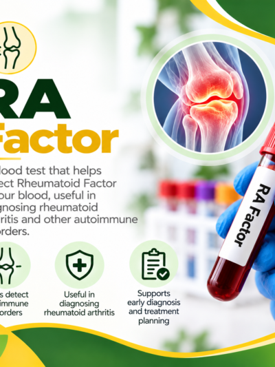 RA Factor
